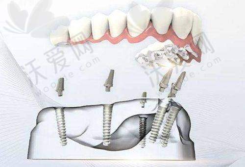 2025年如东县部分牙科医院特色及价格