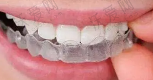 衡水可恩口腔医院特色科室
