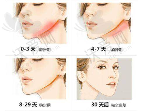 昆明美诗沁医疗美容诊所技术好不好？