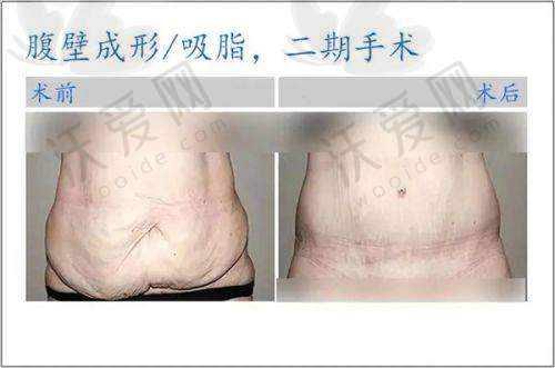 总结评价——兰州五星嘉琳医学美容医院怎么样？