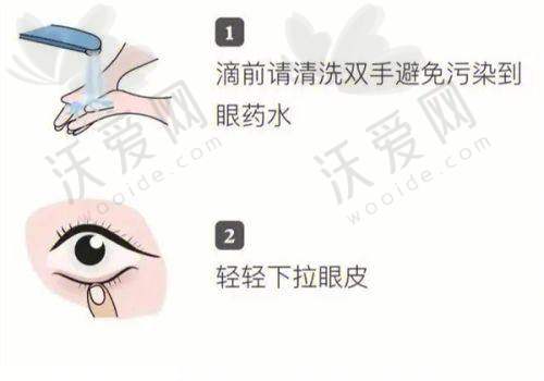 普瑞眼科收费价格贵吗？