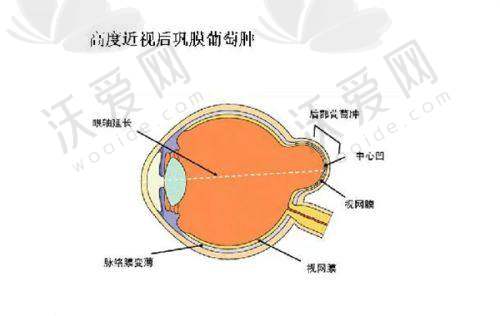广州爱尔眼科在干眼症治疗方面的医院实力如何呢？