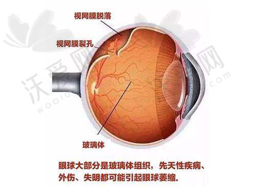 广州爱尔眼科医院在成人配镜验光方面有怎样的专精团队？