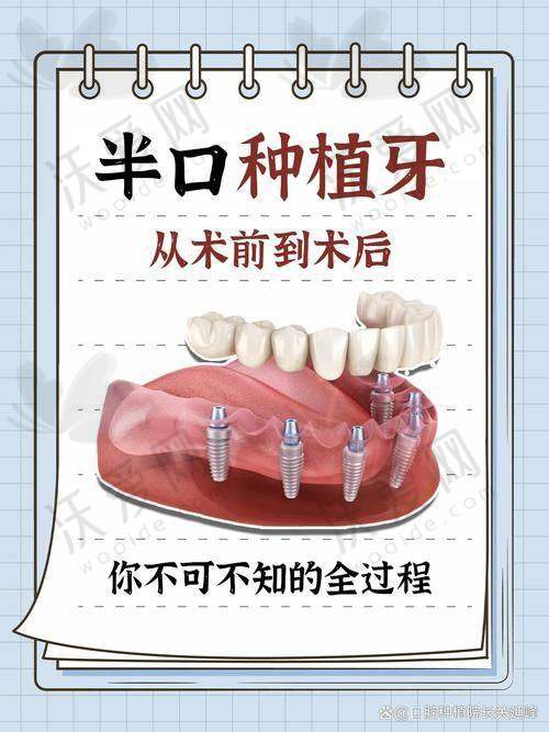 四川宜宾喜牙口腔医院李华斌医生挂号预约攻略