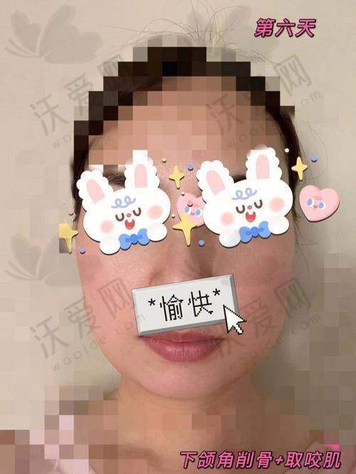 云南华美美莱整形美容医院邓诚医生技术好不好？