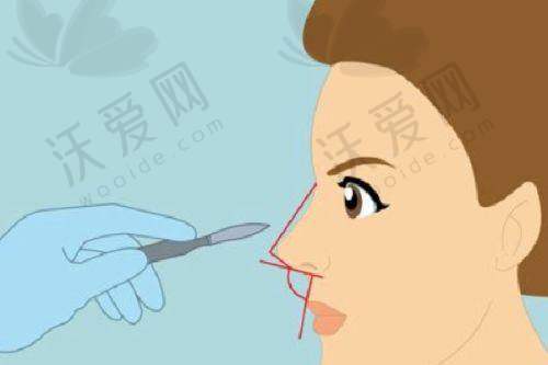 北京市北京奥尔贝德医疗美容门诊部姚然医生技术好不好？