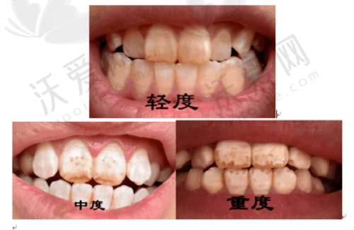 晋中百年中诺口腔诊所技术好不好？