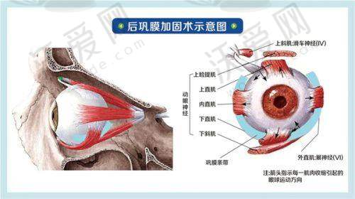 总结——深圳悦瞳眼科医院陈韶红医生怎么样？