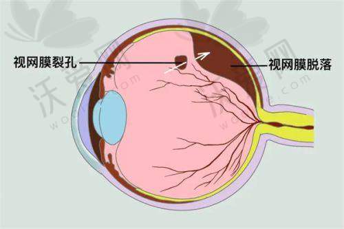 合肥慧视眼科医院地址