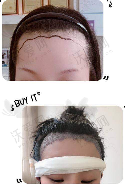 总结——北京奥尔贝德医疗美容门诊部连燕峰医生怎么样？