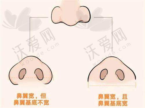 总结评价——广州柳大烈医疗美容门诊部怎么样?