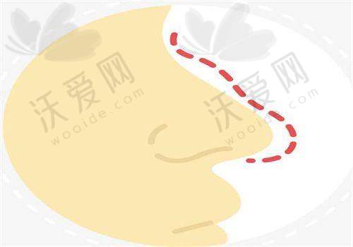 总结评价——长沙鹏爱医疗美容医院怎么样？