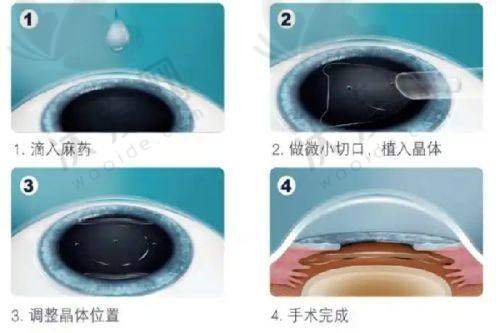 贵阳爱尔眼科医院的医疗设备怎么样？