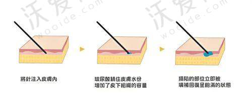 广州柳大烈医疗美容门诊部地址