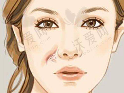 广州米伦医疗美容门诊部电话号码