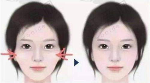 总结评价——广州米伦医疗美容门诊部怎么样？