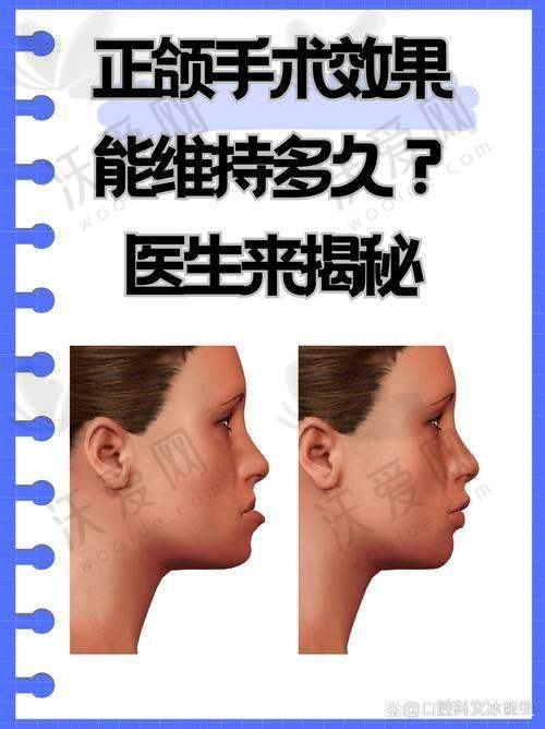 广州柳大烈医疗美容门诊部王涛医生挂号预约攻略