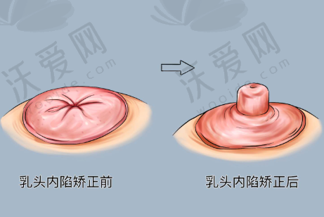 总结——广州米伦医疗美容门诊部张伟医生怎么样？