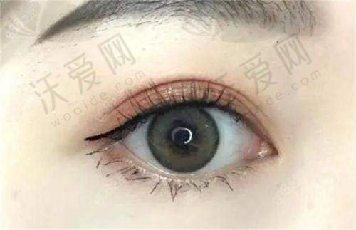 上海眼修复医生杜园园预约挂号是挺难的！但掌握这些预约渠道、技巧能轻松预约杜园园