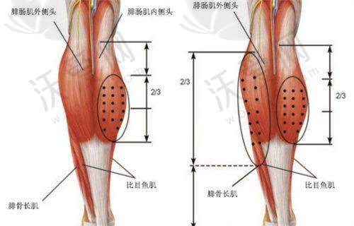四川友谊医院整形美容科双眼皮实例