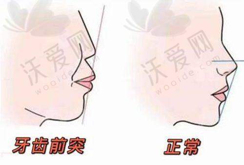 上海松丰口腔门诊部蔡明炎医生技术好不好？
