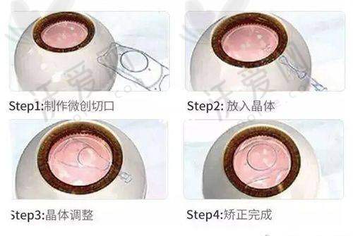成都青羊萌鹰眼科诊所医生名单及简介