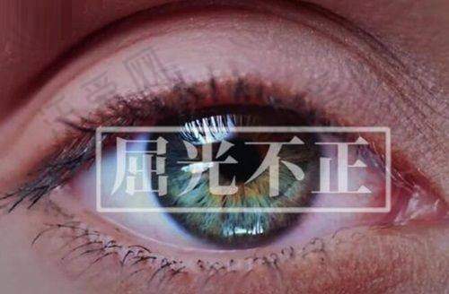 郑州视光眼科医院全飞秒3.0屈光手术的适用人群