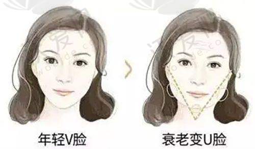 总结——长沙鹏爱医疗美容医院张巍医生怎么样？