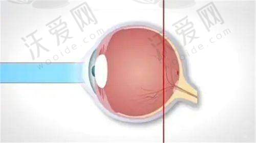 成都青羊萌鹰眼科诊所硬件设备精良！