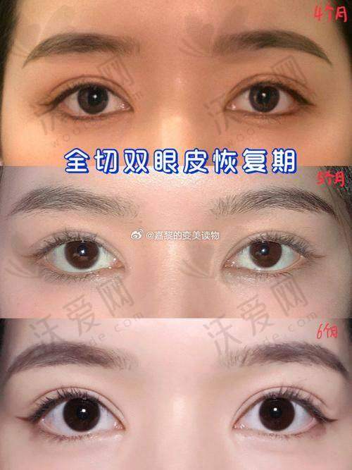 上海眼修复医生杜园园预约渠道的两大入口