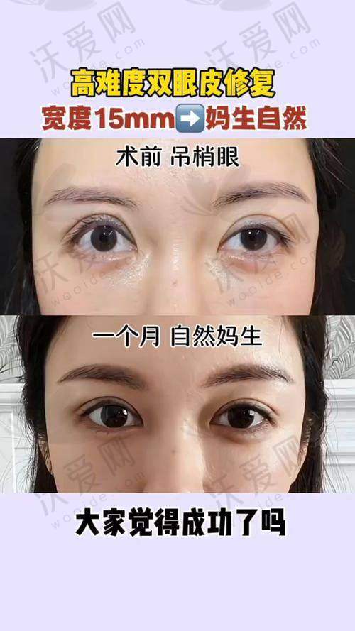 从医师简介看刘志刚眼修复成效