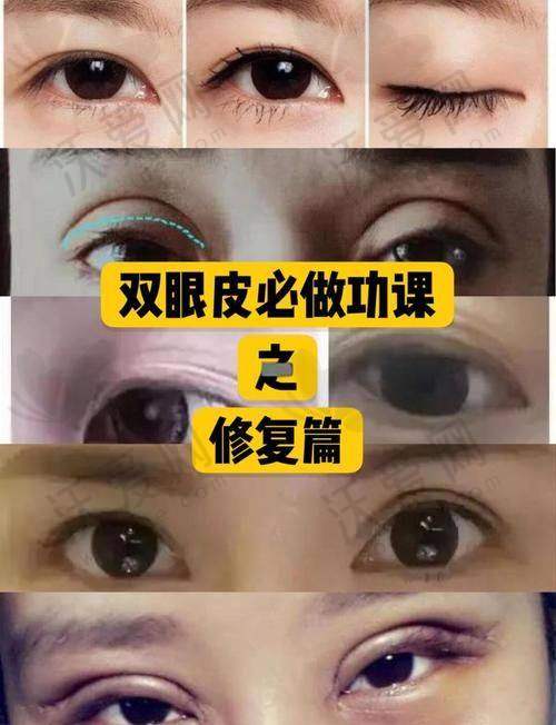 上海眼修复医生杜园园金刀奖评委的技术密码