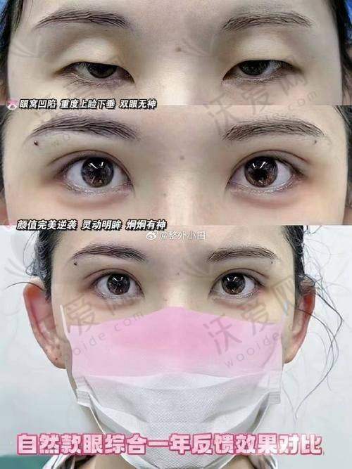 上海眼修复医生杜园园特殊需求的应对方案