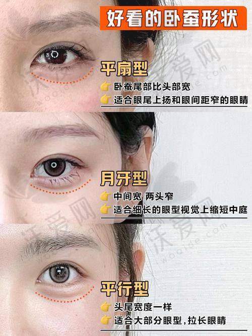 上海爱尚丽格微创丰卧蚕：专精医生团队，不错技术保护