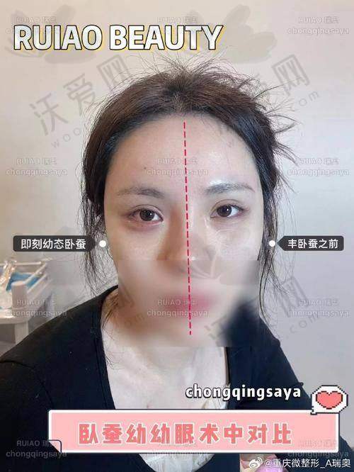 上海爱尚丽格收费标准参考