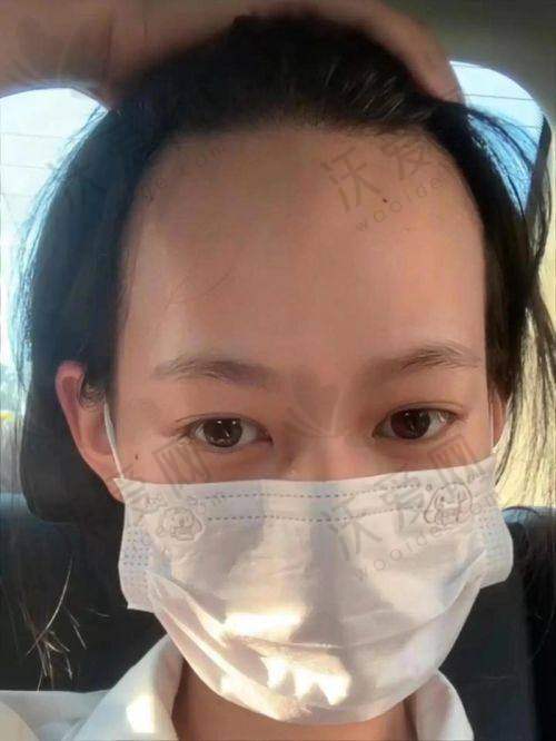 武汉仁爱种发际线价格优惠技术靠谱且医院正规，多项目实惠价助发友重拾浓密秀发