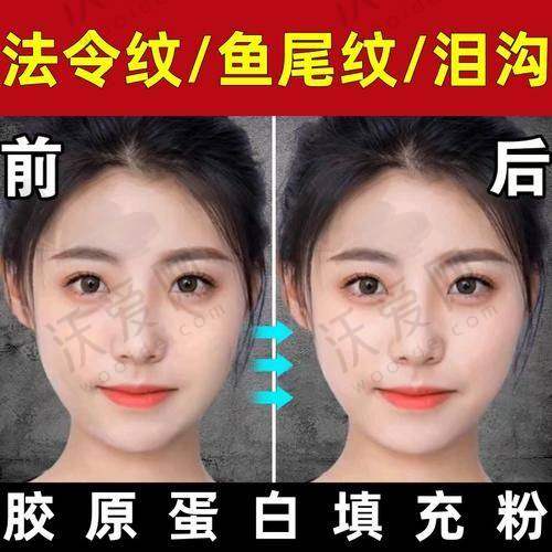 上海伊莱美整形李玲医生是什么样的医生？