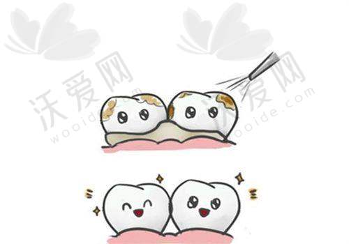 牙博士2025单颗种植牙不同品牌价格
