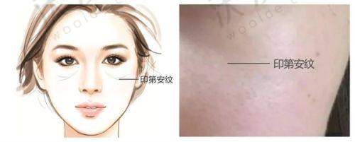 深圳安美聚光医疗美容门诊部地址