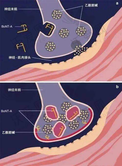深圳美诗沁港丹医疗美容腰腹吸脂实例