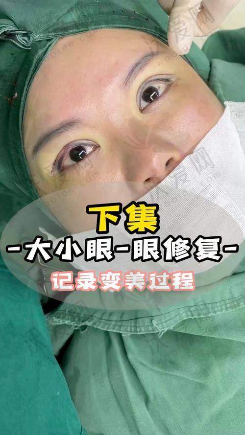 总结——深圳丽港丽格医疗美容医院石东文医生怎么样？