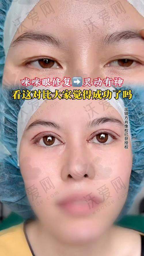 深圳丽港丽格医疗美容医院石东文医生挂号预约攻略