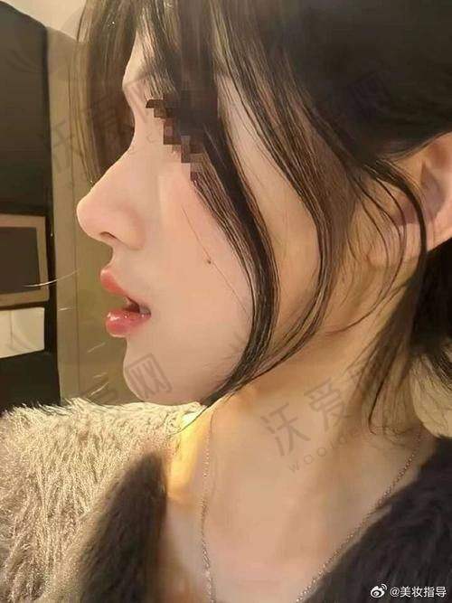 深圳做鼻子李信锋医生个人简介超全！20多年经验鼻整形技术与个性化理念大放异彩