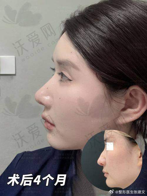 深圳宝丽医疗美容整形门诊部李信锋医生擅长领域