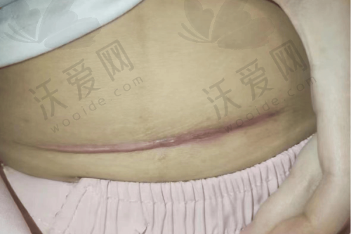 四川成都疤研疤痕门诊部科室齐全！