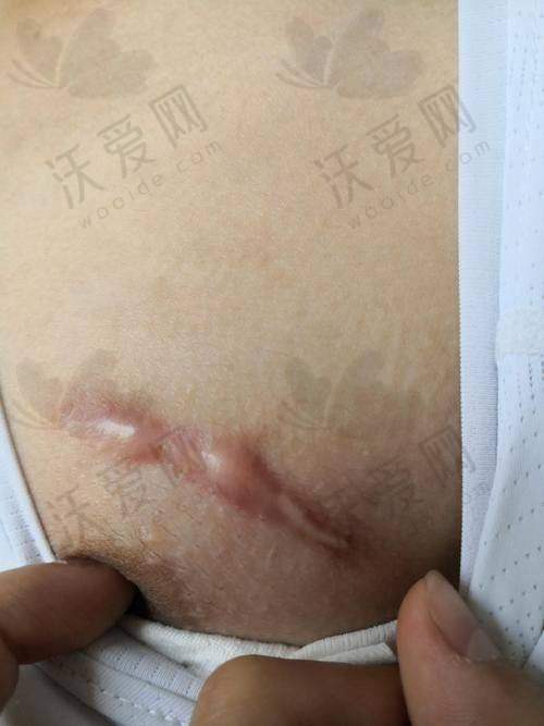 重庆郑荃丽格疤痕修复中 心电话号码