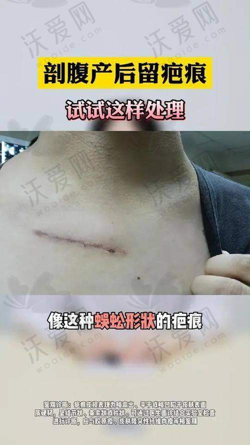 重庆郑荃丽格疤痕修复中 心医生名单及简介
