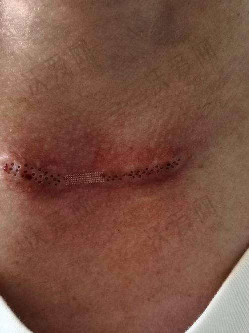 重庆郑荃丽格疤痕修复中 心地址