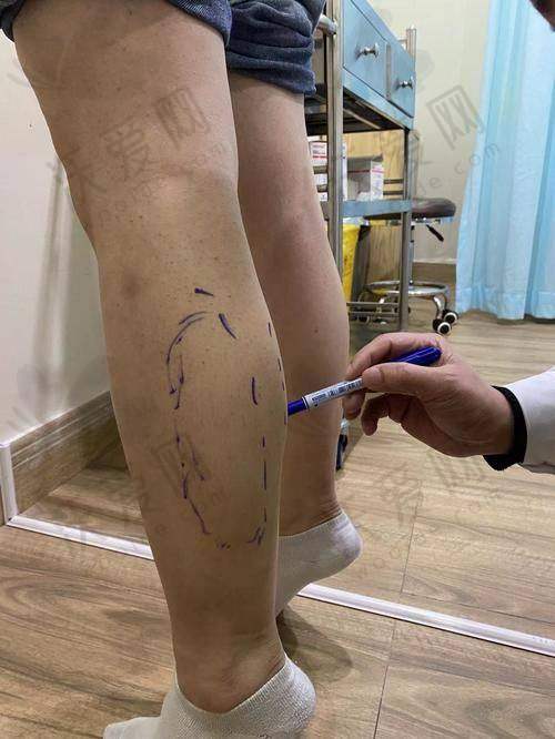 北京樱桃医疗美容诊所金尚训医生技术好不好？