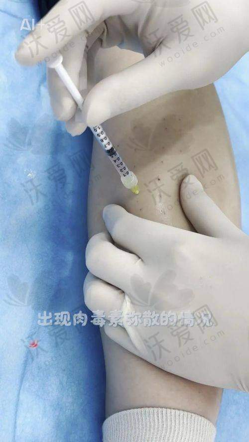 北京樱桃医疗美容诊所金尚训医生挂号预约攻略
